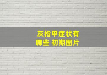 灰指甲症状有哪些 初期图片